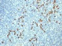 Formalin-fixed, paraffin embedded human tonsil sections stained with 100 ul anti-Lambda Light Chain (clone HP6054) at 1:200. HIER epitope retrieval prior to staining was performed in 10mM Citrate, pH 6.0.